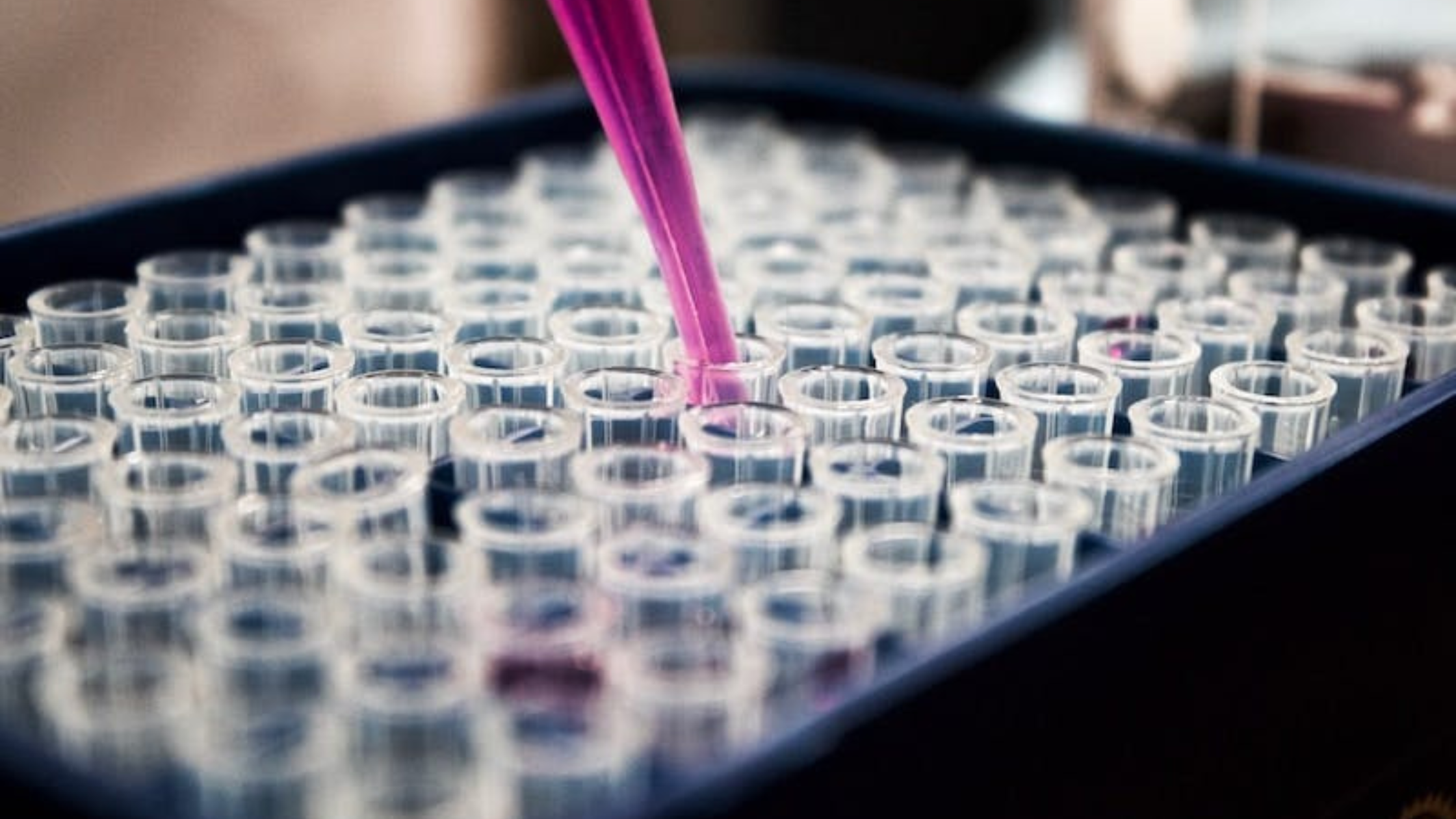 A blue tray with clear plastic tubes, a pink pipette, and a laboratory setting.
